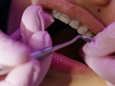 Can an Orthodontist Refuse to Remove Braces? Can an Orthodontist Refuse to Remove Braces?