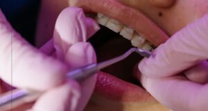 Can an Orthodontist Refuse to Remove Braces? Can an Orthodontist Refuse to Remove Braces?