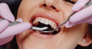 Why is Dental Insurance so Bad? Why is Dental Insurance so Bad?