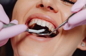 Why is Dental Insurance so Bad? Why is Dental Insurance so Bad?