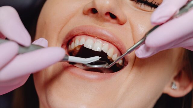 Why is Dental Insurance so Bad?