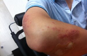 How To Settle Disputes With Your Boss After An Accident?