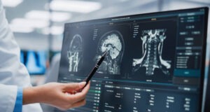 How Can a Brain Injury Complicate Your Life?